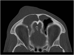 Case of the month April 2006: Skull and extracranial structures