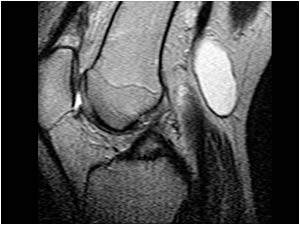 Dorsal side knee