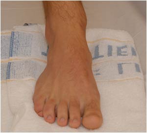 Dorsal aspect of the foot: Interdigital space transverse
