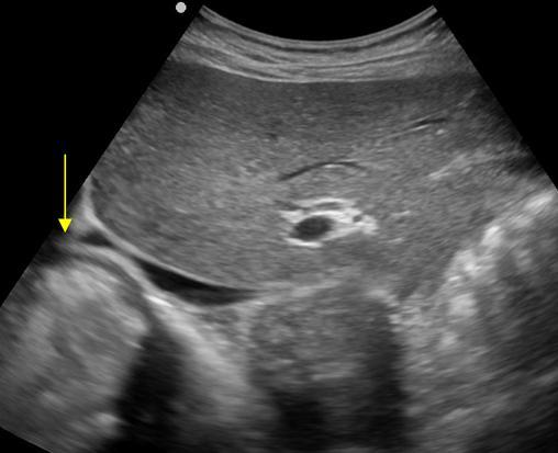Abdomen And Retroperitoneum 1 6 Gastrointestinal Tract Case 1 6 6