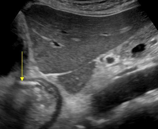 Abdomen And Retroperitoneum 1 6 Gastrointestinal Tract Case 1 6 6
